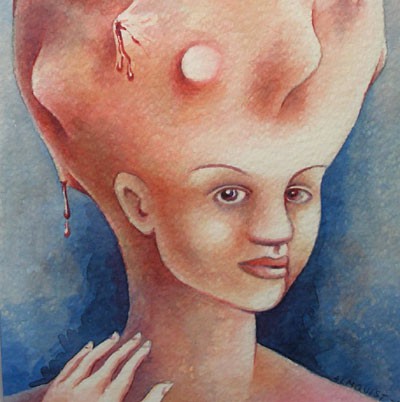 The body